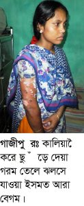 Gazipur- 16 June 2016-Child and her Mother body thrown into hot oil-1